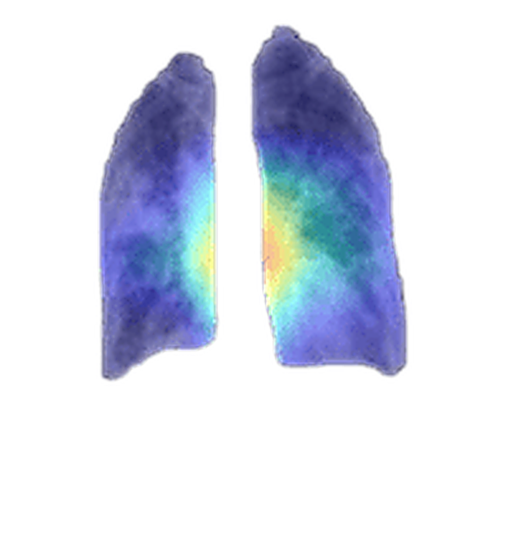Radiography Visual Saliency Heatmap